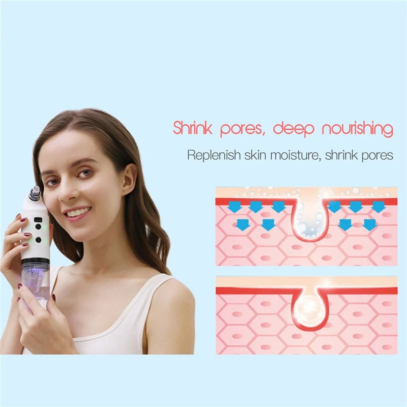 Hydrating Face Cleaning & Peeling Vacuum