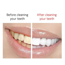 Ultrasonic Plaque & Tartar Dental Set