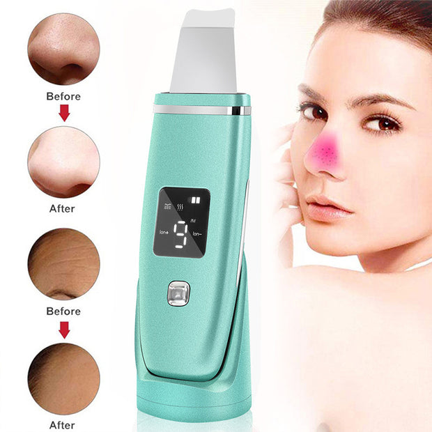 Ultrasonic Blackhead Remover & Deep Pore Cleaner